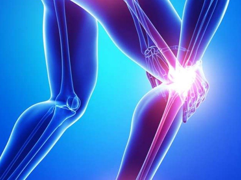 Fisioterapia na Artrite: alívio da dor, mais mobilidade e qualidade de vida